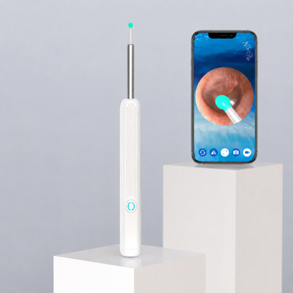 Glowence Ear Cleaner with Real-Time HD Camera | Safe At-Home Ear Wax Removal