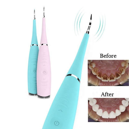 Glowence  Plaque remover