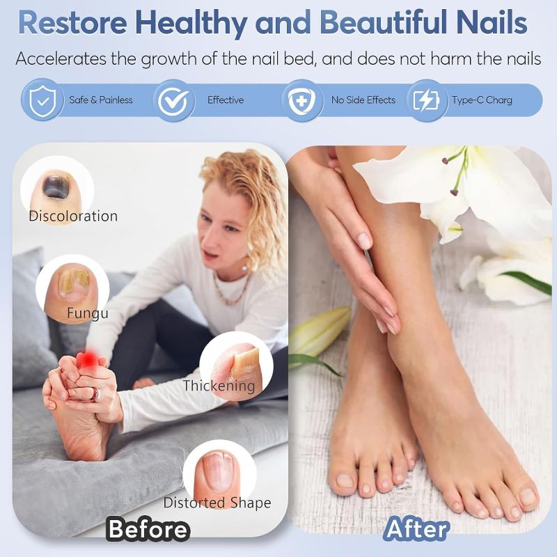 Glowence Nail Fungus Device