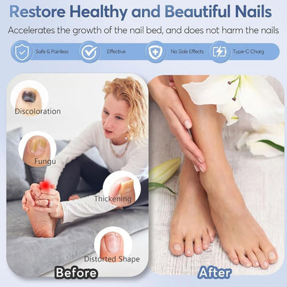 Glowence Nail Fungus Device