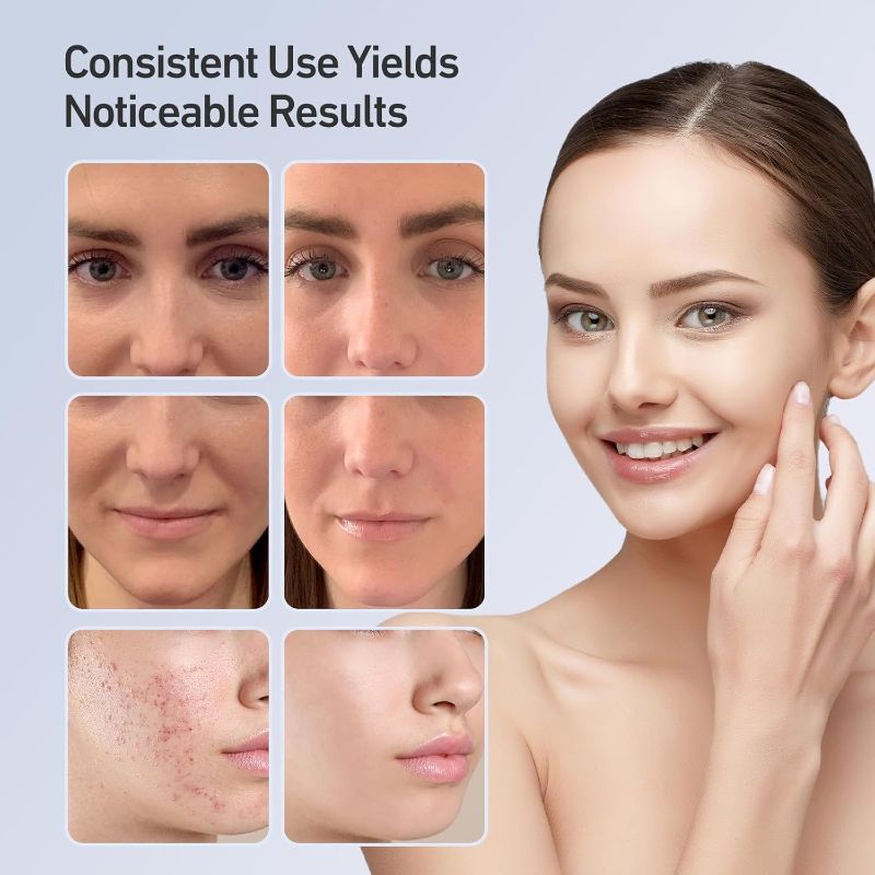 Glowence LED Light Face Mask