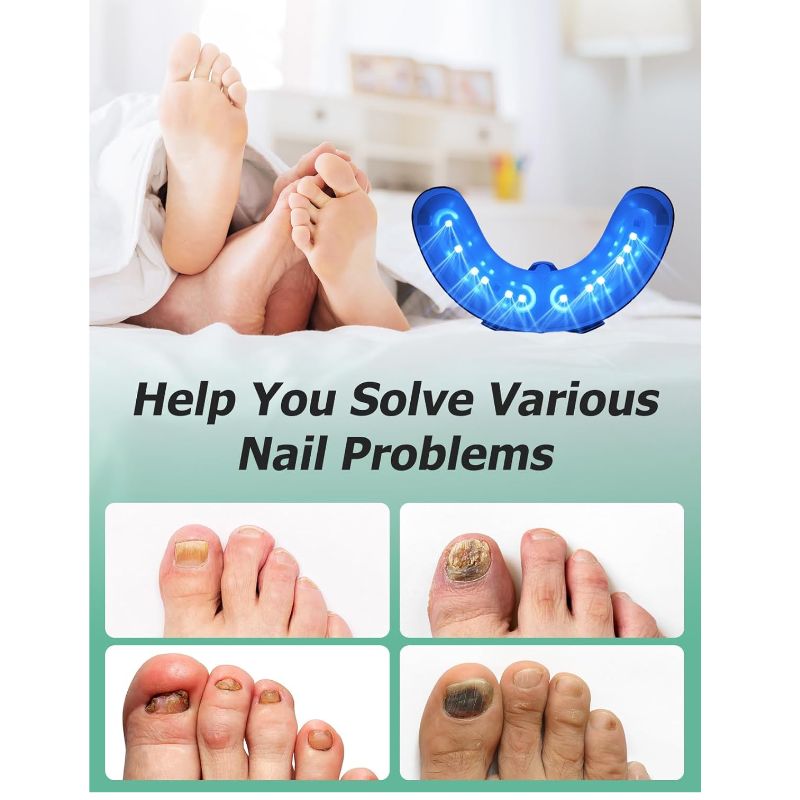 Glowence Nail Fungus Device