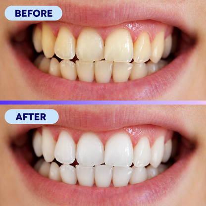 Glowence Purple Whitening Foam